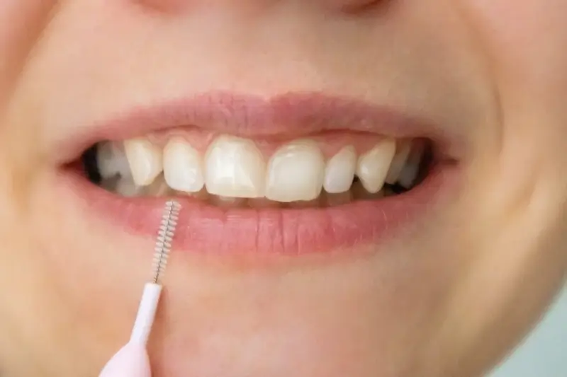 Kilka słów o leczeniu stomatologicznym