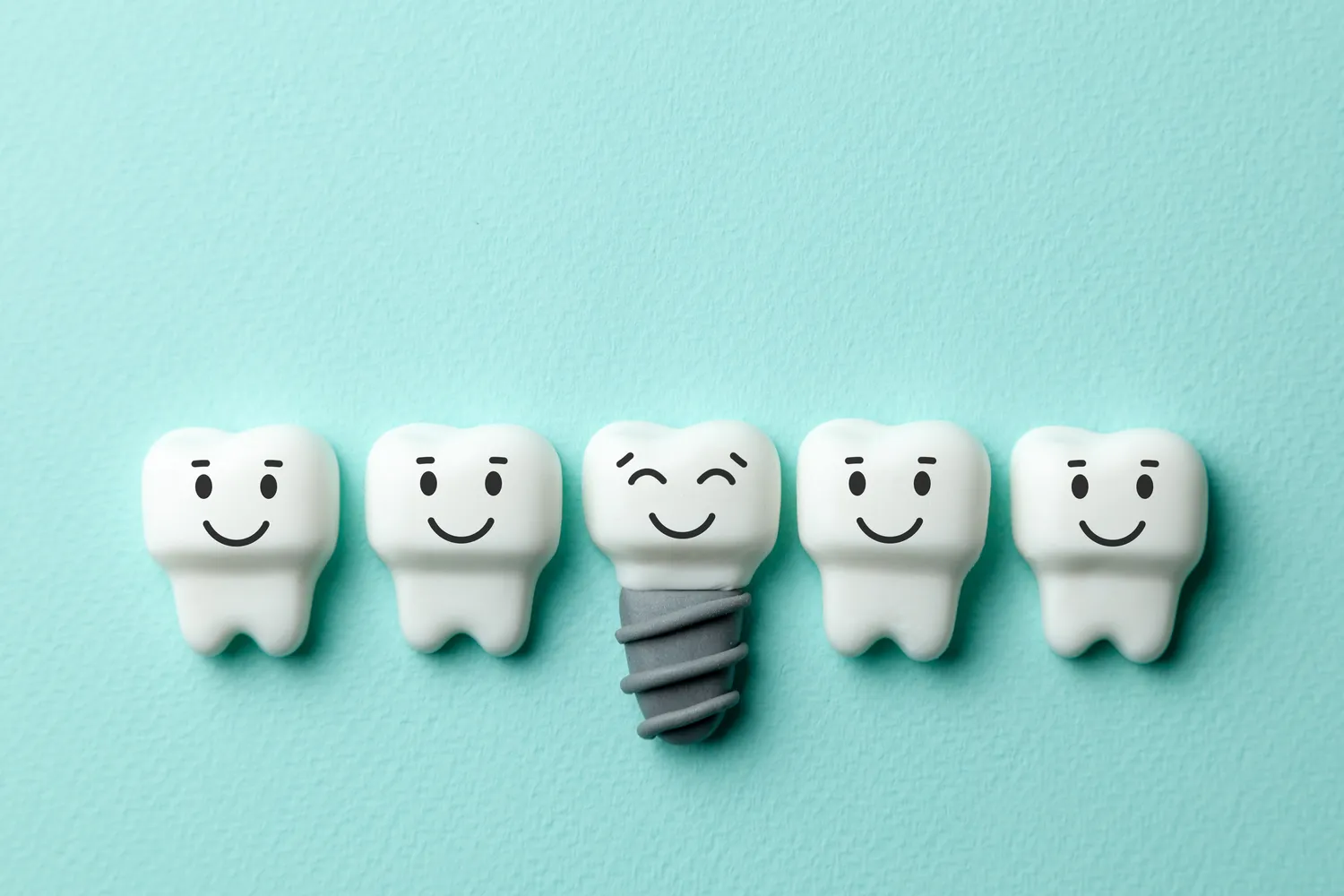 Implanty zębowe rodzaje - najważniejsze kwestie