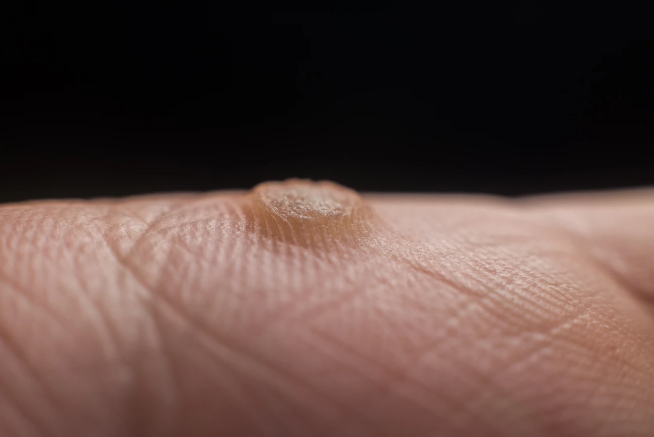 Kompleksowy przewodnik po podologii - co trzeba o niej wiedzieć?