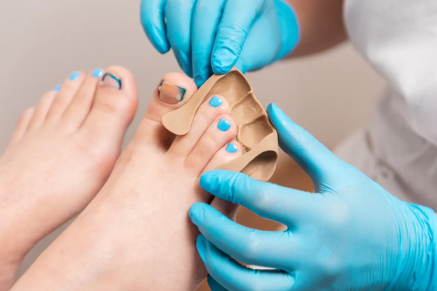 Pedicure leczniczy - czym jest i co warto wiedzieć na jego temat?